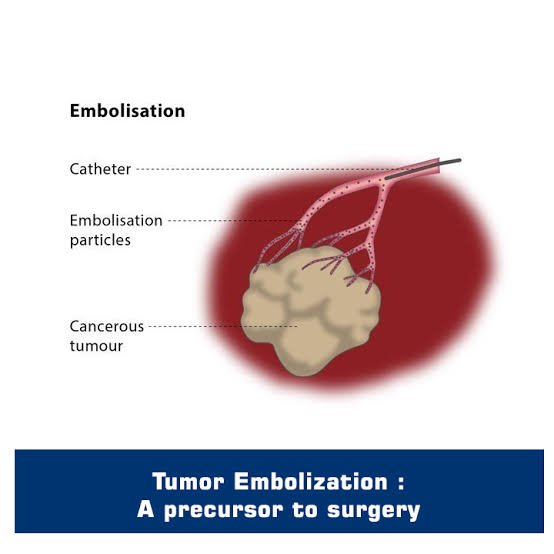Vascular Malformation Treatment Odisha