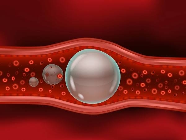 Tumor Embolization in Odisha Bhubaneswar