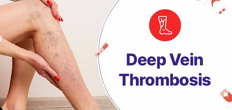 Best Arteriovenous Fistula doctor in Odisha